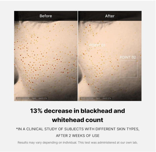 Medicube Zero Pore One Day Serum Серум за лице