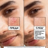 Garnier Pure Active Salicylic 7-Day Clinical Anti-Blemish Serum Серум против несъвършенства