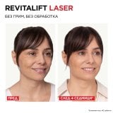 L'Oreal Paris Dermo Revitalift Laser X3 Дневен крем за лице