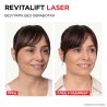 L'Oreal Paris Dermo Revitalift Laser X3 Дневен крем за лице