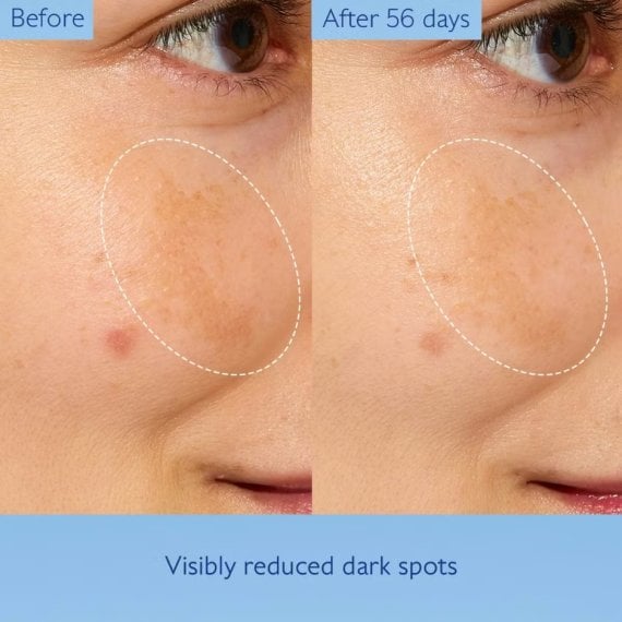 Caudalie Vinoperfect Концентрирана изсветляваща гликолова есенция