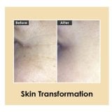 Medi-Peel Hyaluronic Volumizing Eye Cream Околоочен крем