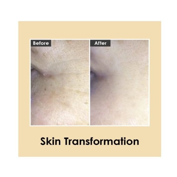 Medi-Peel Hyaluronic Volumizing Eye Cream Околоочен крем