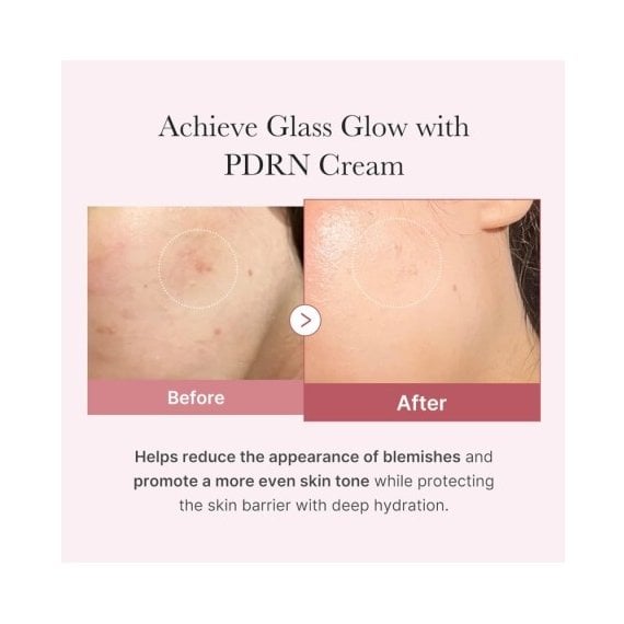Medicube PDRN Pink Hyaluronic Moisturizing Cream Хидратиращ крем за лице