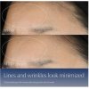 Estee Lauder Advanced Night Repair Synchronized Multi Recovery Complex Серум за лице