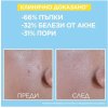 Garnier Pure Active SPF50+ Матиращ флуид против несъвършенства
