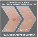 Garnier Pure Active Charcoal Серум против несъвършенства