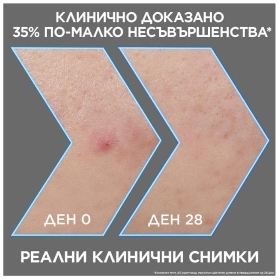 Garnier Pure Active Charcoal Серум против несъвършенства