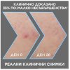 Garnier Pure Active Charcoal Серум против несъвършенства