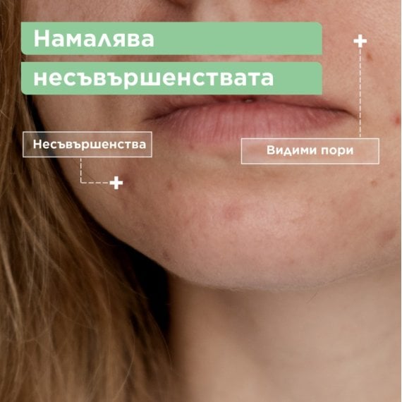 Mixa Anti-Imperfection Почистващ гел за лице против несъвършенства