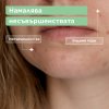 Mixa Anti-Imperfection Почистващ гел за лице против несъвършенства