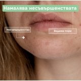 Mixa Anti-Imperfection Флуид против несъвършенства