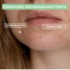 Mixa Anti-Imperfection Флуид против несъвършенства