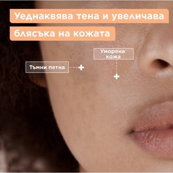 Mixa Anti-Dark Spot SPF20 Флуид против тъмни петна