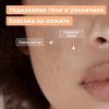 Mixa Anti-Dark Spot SPF20 Флуид против тъмни петна