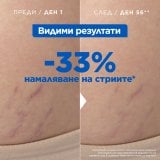 Mixa Stretch Mark Oil Масло против стрии