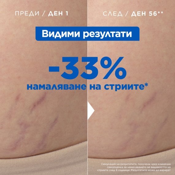 Mixa Stretch Mark Oil Масло против стрии