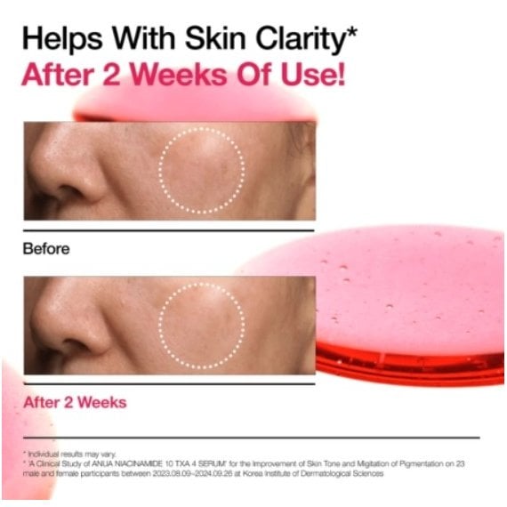 Anua Niacinamide 10% + TXA 4% Serum Серум за лице