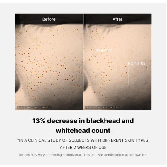 Medicube Zero Pore One Day Serum Серум за лице