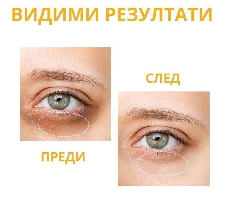 OOTD Dark Circle Eye Serum Околоочен серум за очи против тъмни кръгове