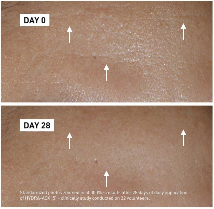 Filorga Hydra Aox 5 Intensive Antioxidant Serum Интензивен антиоксидантен серум за лице